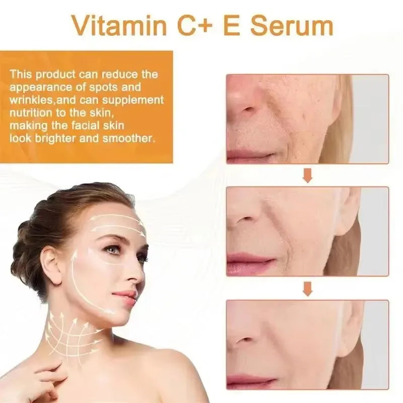 Vitamine C Whitening Serum — Vlekken Verwijderen, Brightening & Huidherstel
