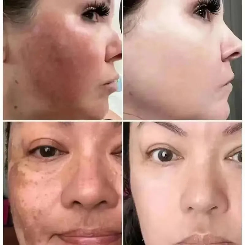 Vitamine C Whitening Serum — Vlekken Verwijderen, Brightening & Huidherstel
