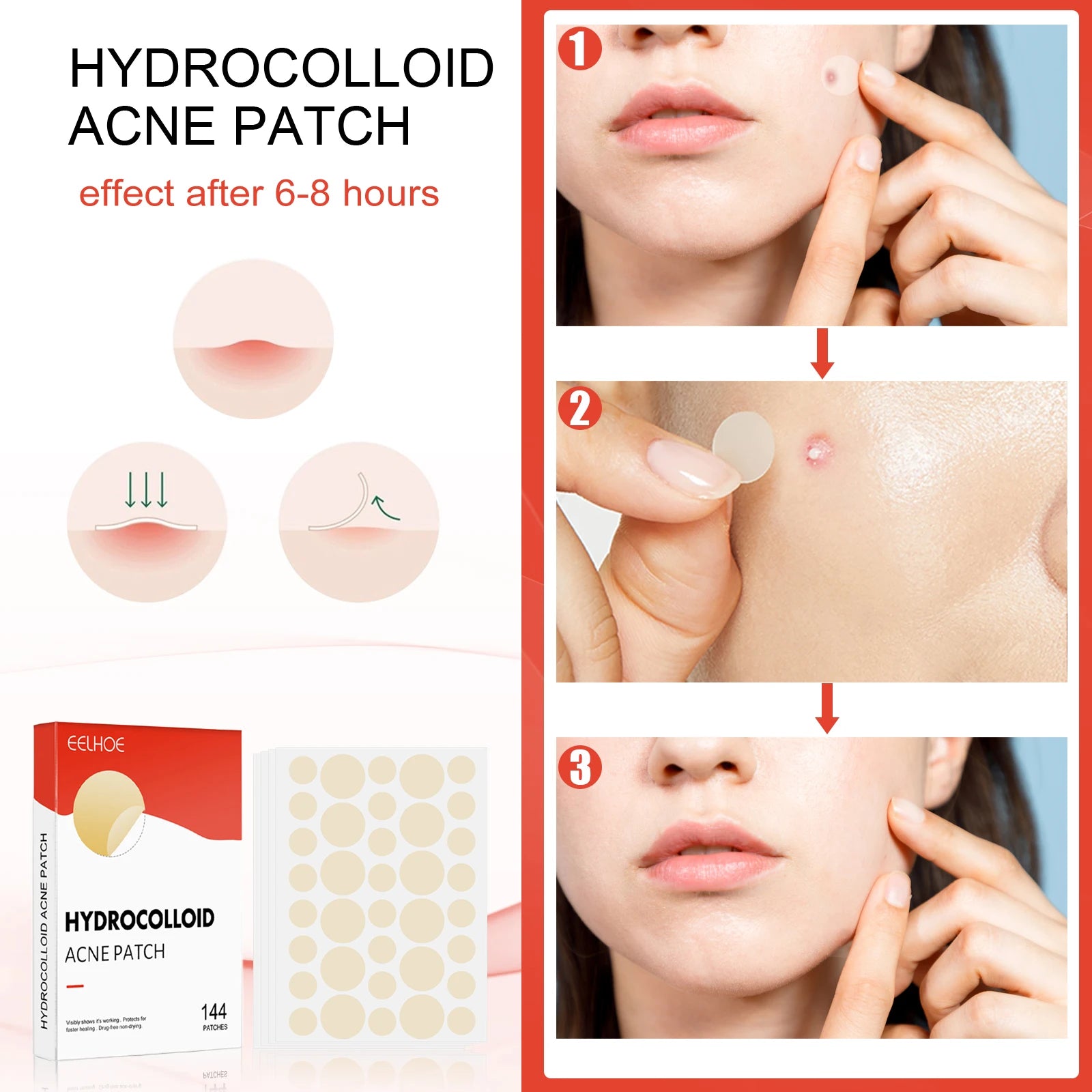 Hydrocolloid Acne Patches — Onzichtbare Puistjesbehandeling
