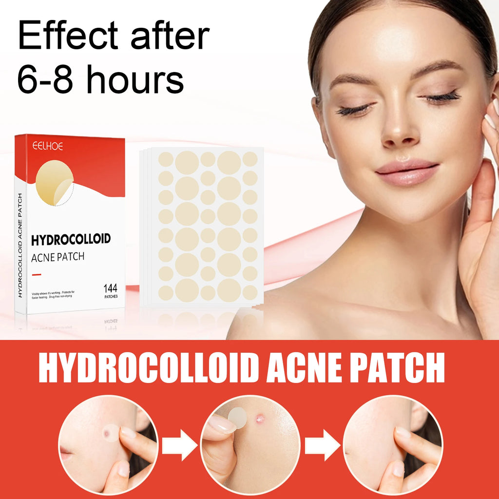 Hydrocolloid Acne Patches — Onzichtbare Puistjesbehandeling