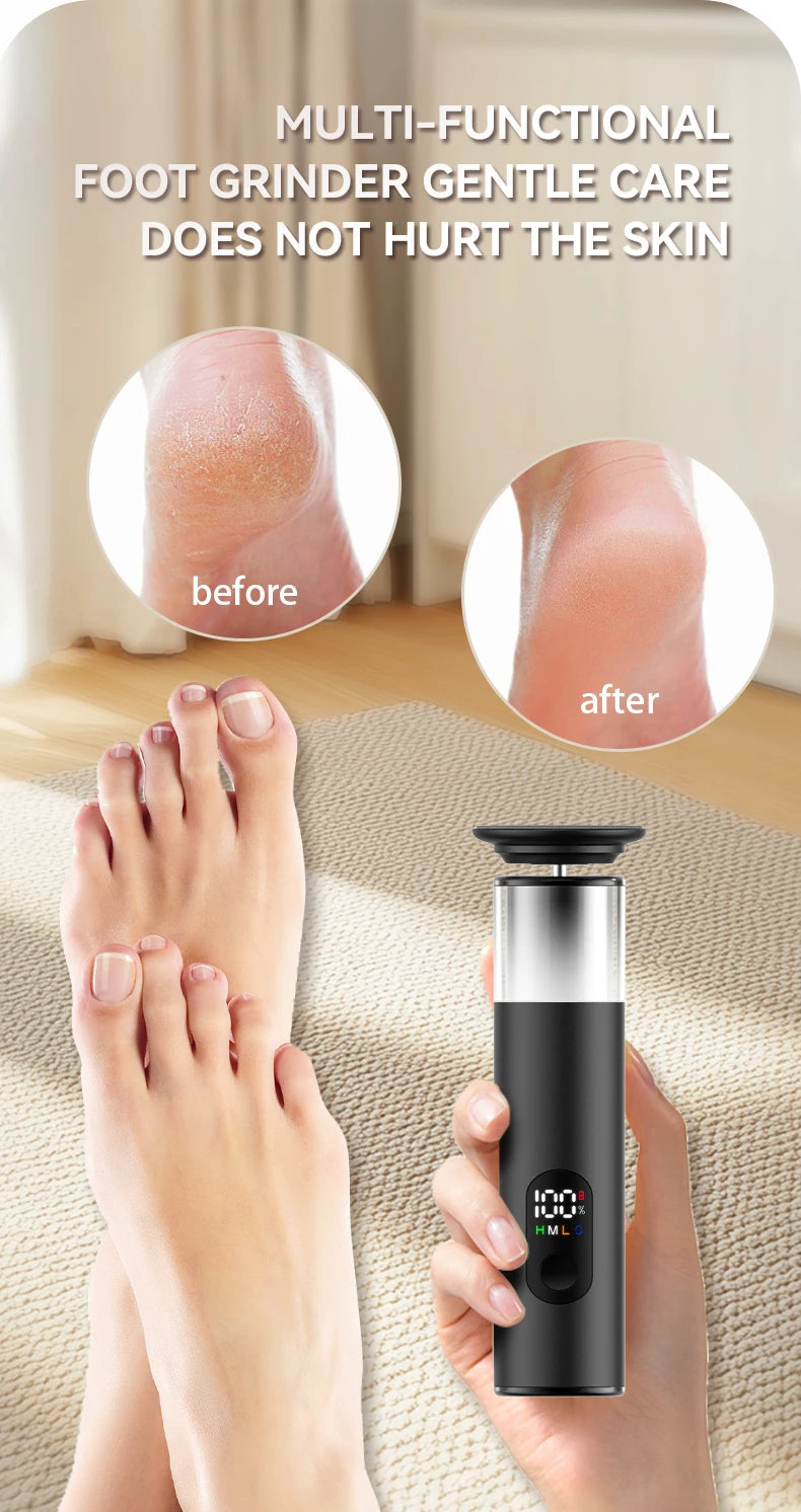 Electric Foot Grinder For Feet, 2-In-1 Foot File & Nail Polisher, Electric Callus Remover Pedicure File Unisex With Gift Box Kenza Beauty Lab