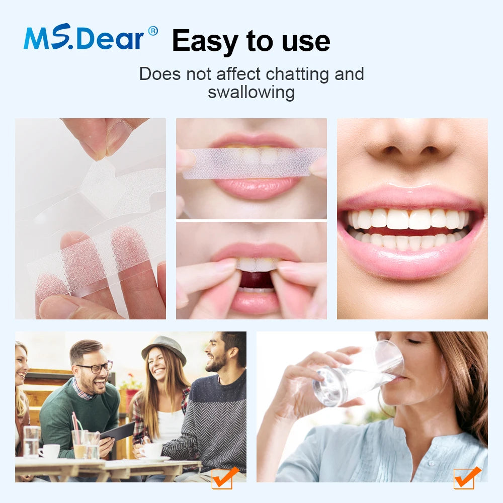 9D Gel Teeth Whitening Strips — Professionele Tandbleking Thuis