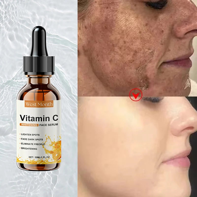Vitamine C Whitening Serum — Vlekken Verwijderen, Brightening & Huidherstel