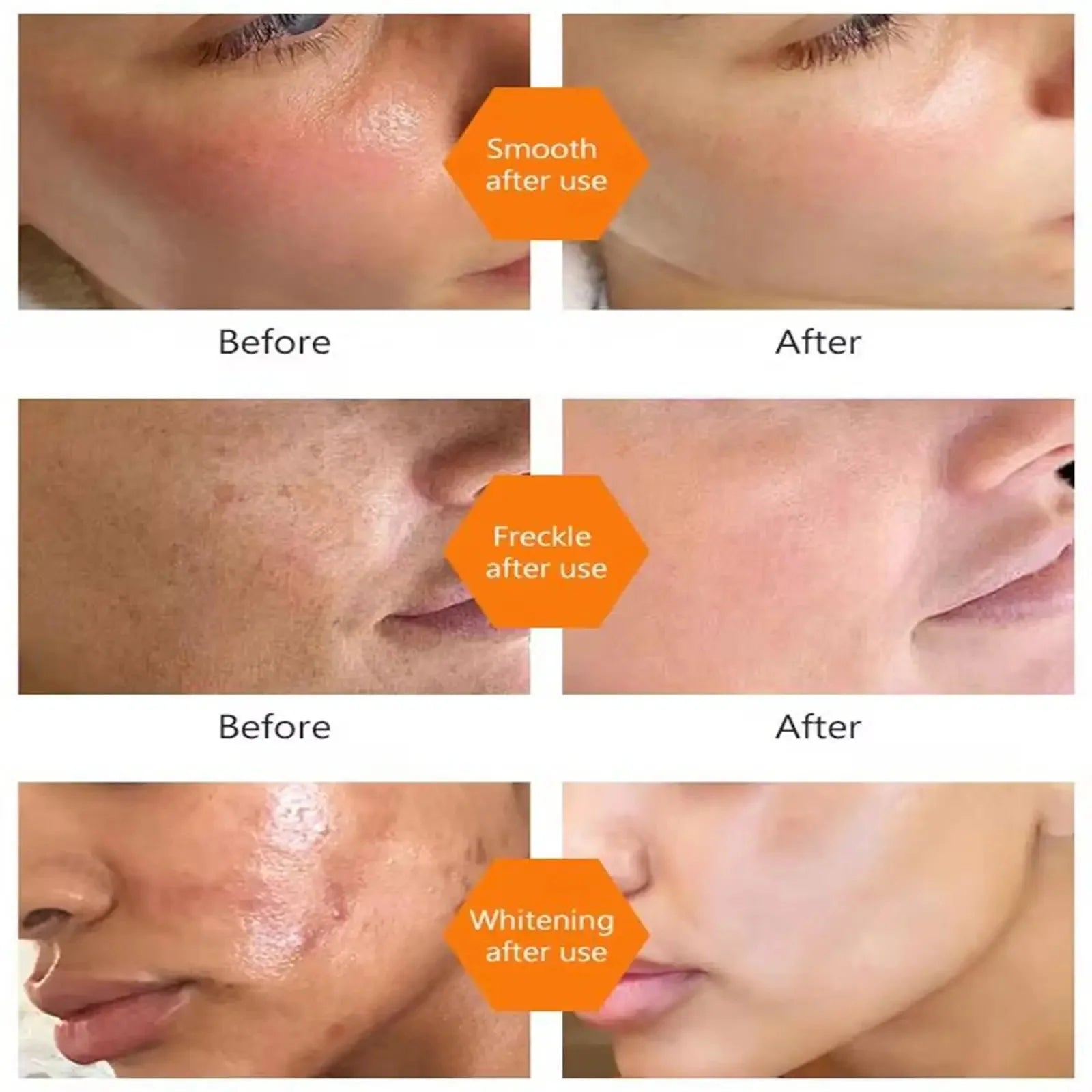 Vitamine C Whitening Serum — Vlekken Verwijderen, Brightening & Huidherstel