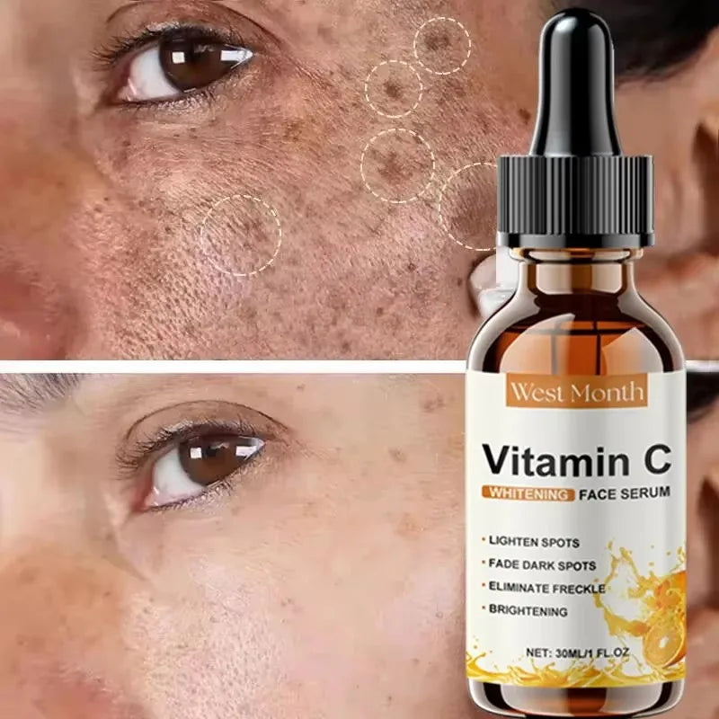 Vitamine C Whitening Serum — Vlekken Verwijderen, Brightening & Huidherstel