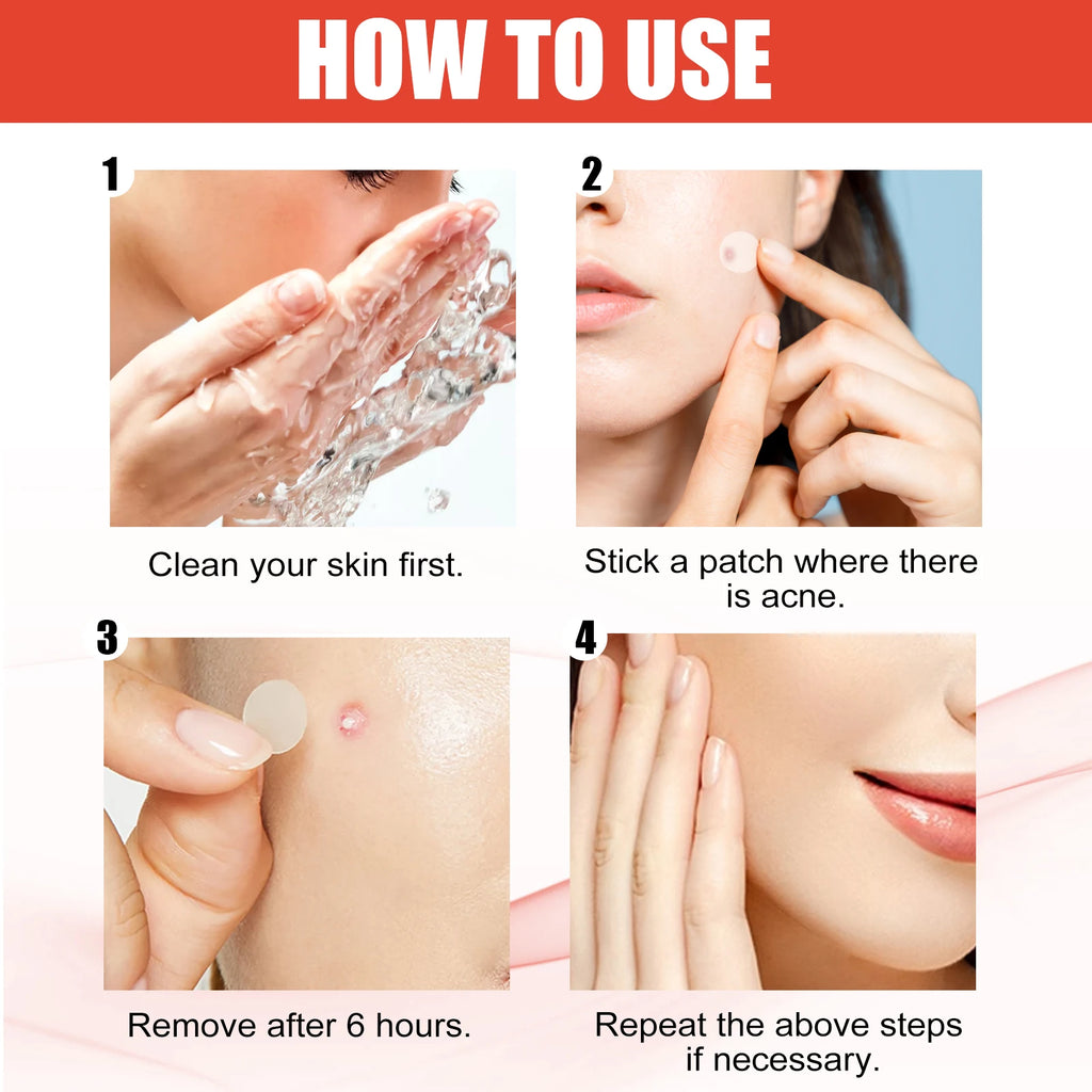 Hydrocolloid Acne Patches — Onzichtbare Puistjesbehandeling