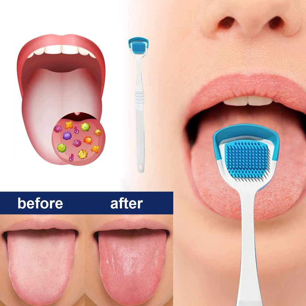 Siliconen Tongborstel — Zachte Tongschraper voor Frisse Adem & Mondhygiëne