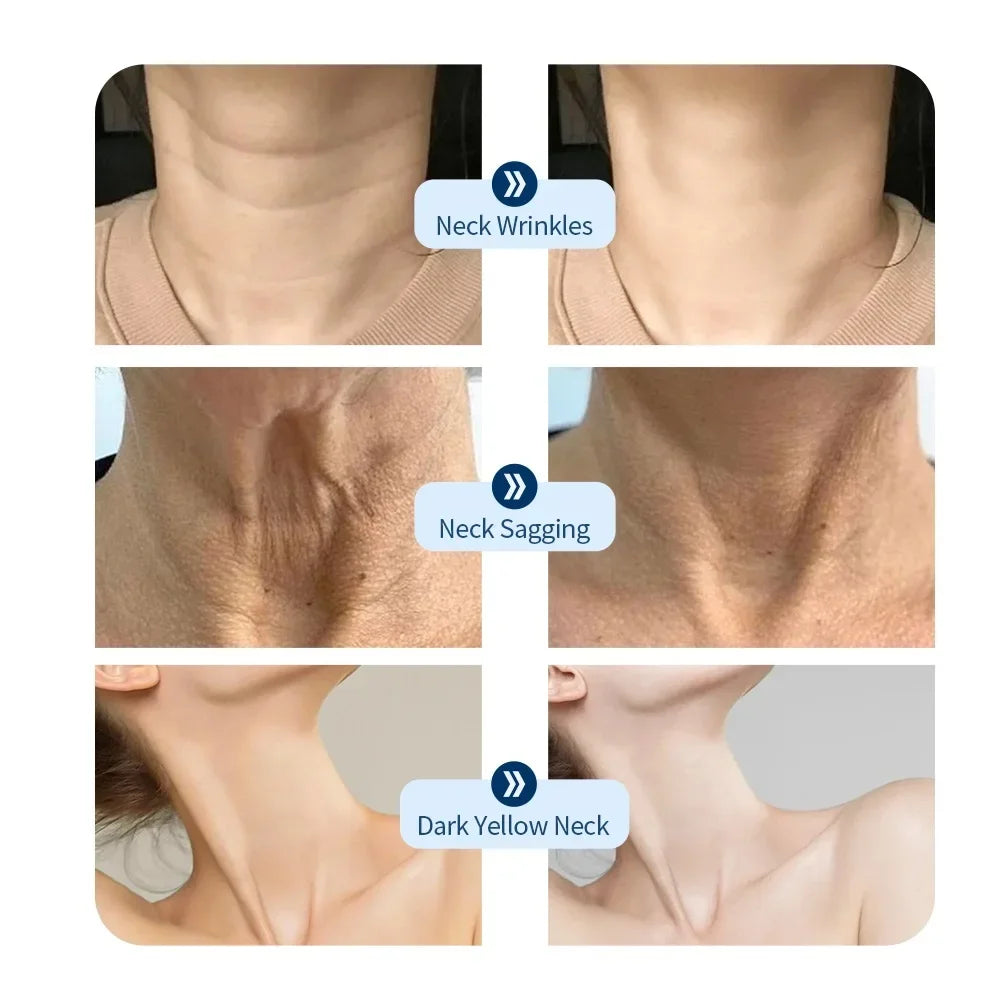 7-Kleuren Photon Nek LED Masker – Roodlicht Therapie, Anti-Aging & Huidverjonging