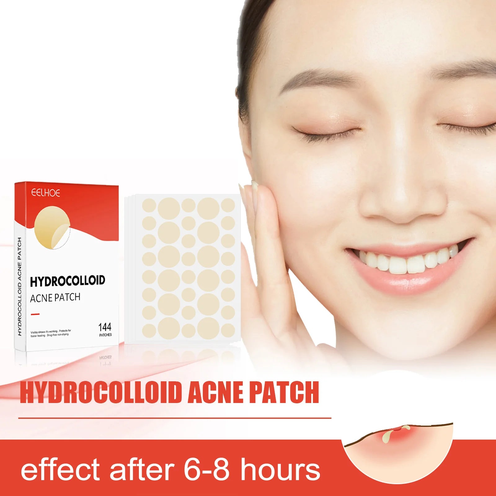 Hydrocolloid Acne Patches — Onzichtbare Puistjesbehandeling