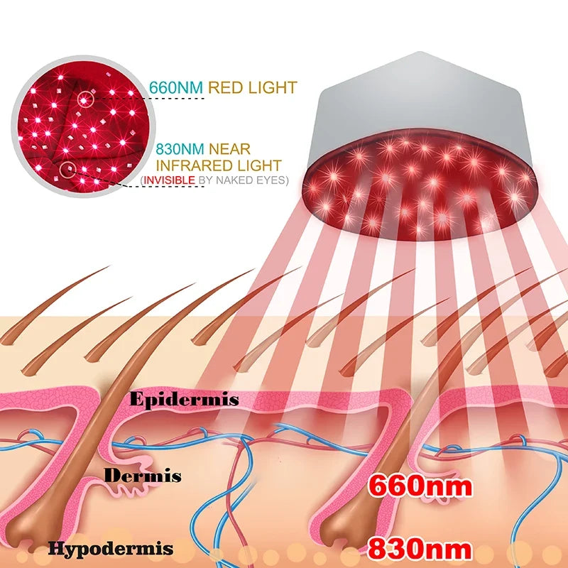 Roodlichttherapie Haargroei Helm 660nm & 830nm — zijaanzicht