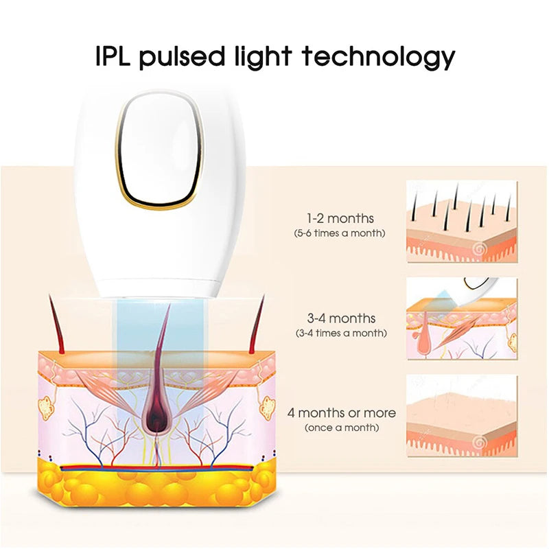 IPL Laser Epilator 999.900 Flitsen — Pijnloze Permanente Ontharing