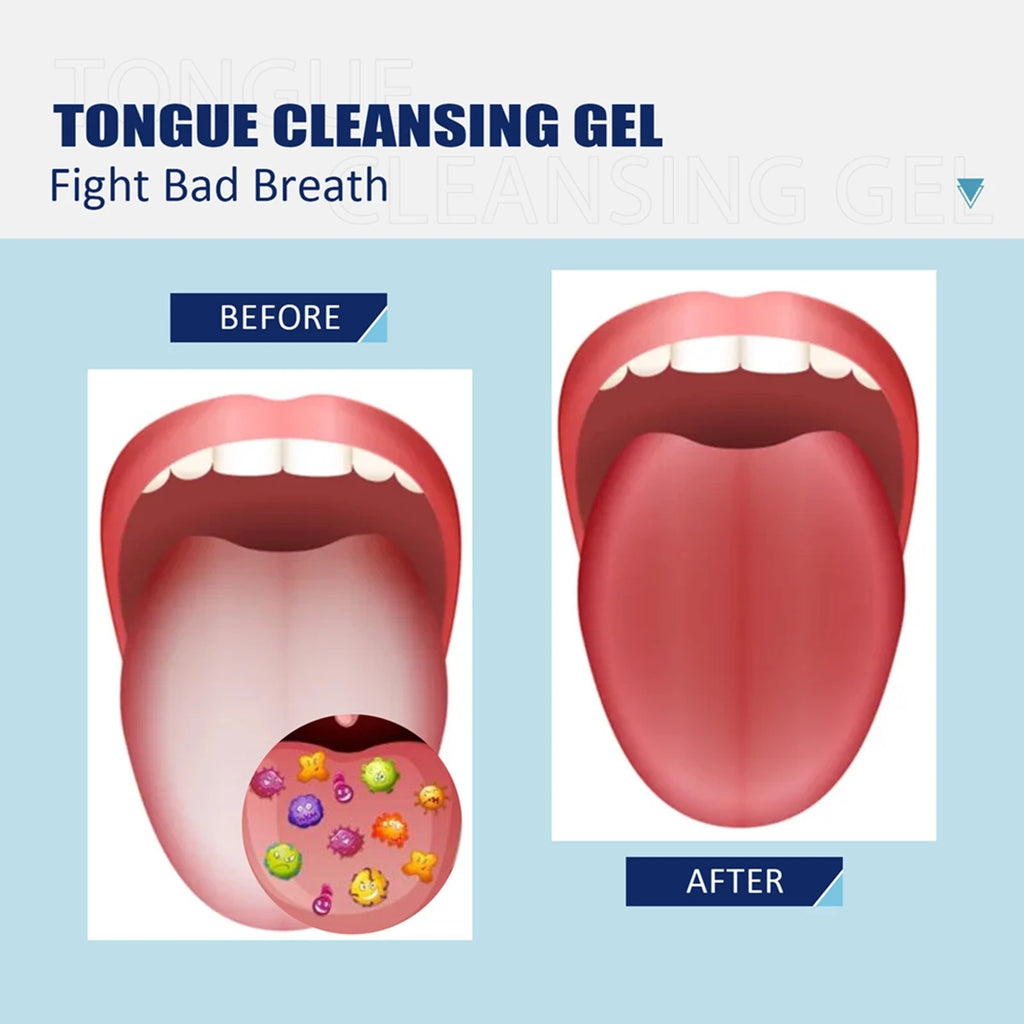 Siliconen Tongborstel — Zachte Tongschraper voor Frisse Adem & Mondhygiëne